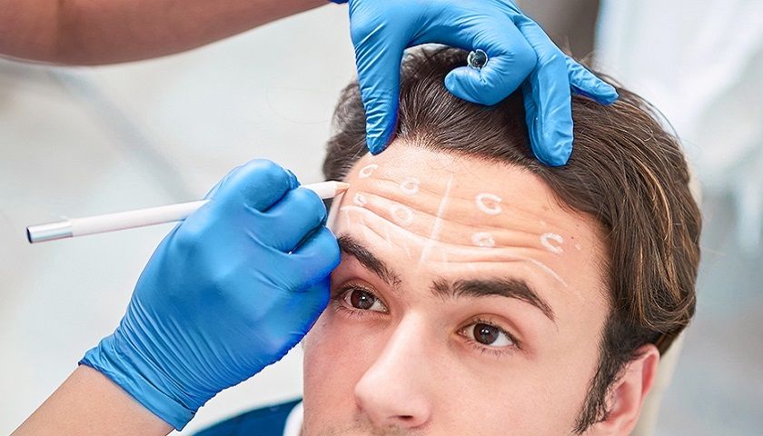 Набирающая популярность ботулинотерапия для мужчин («Brotox»)