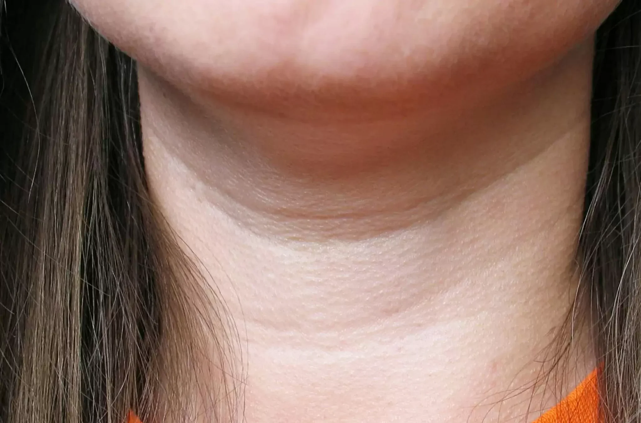 How to lose weight in the neck
