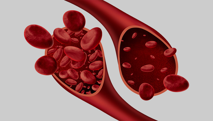 What tests should be done for anemia