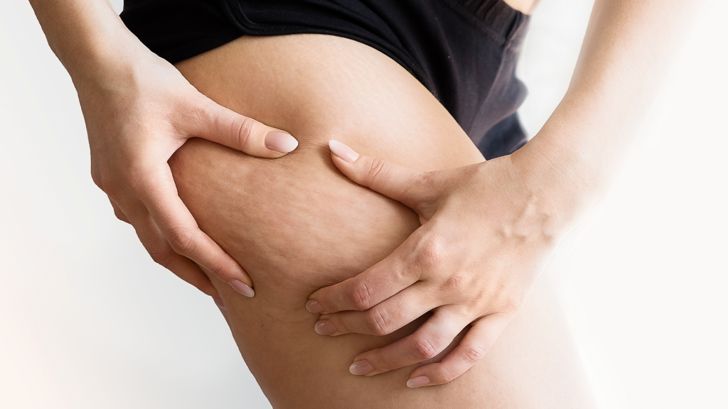 Best cellulite reduction treatments in Abu Dhabi