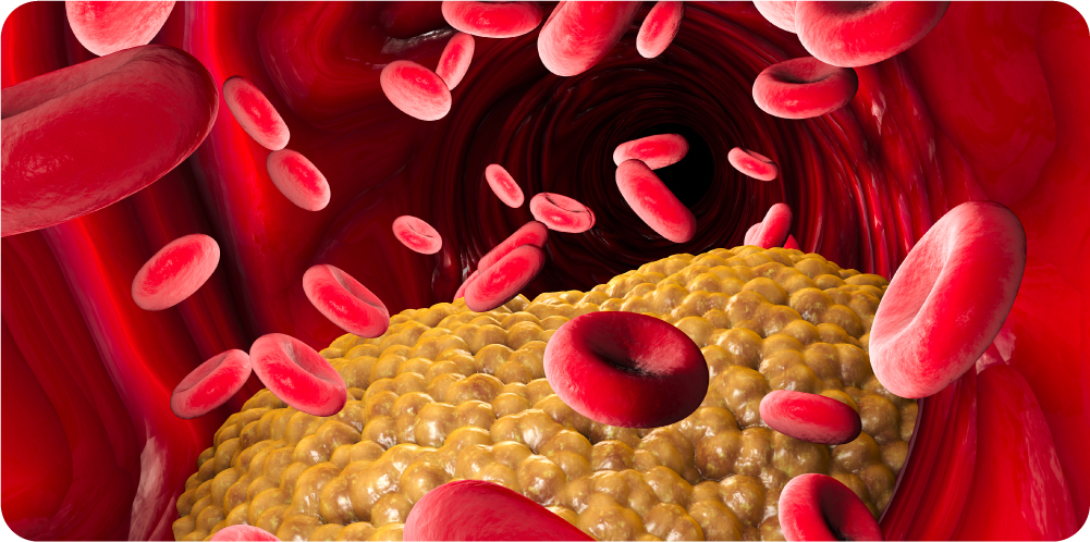 Cholesterol treatment