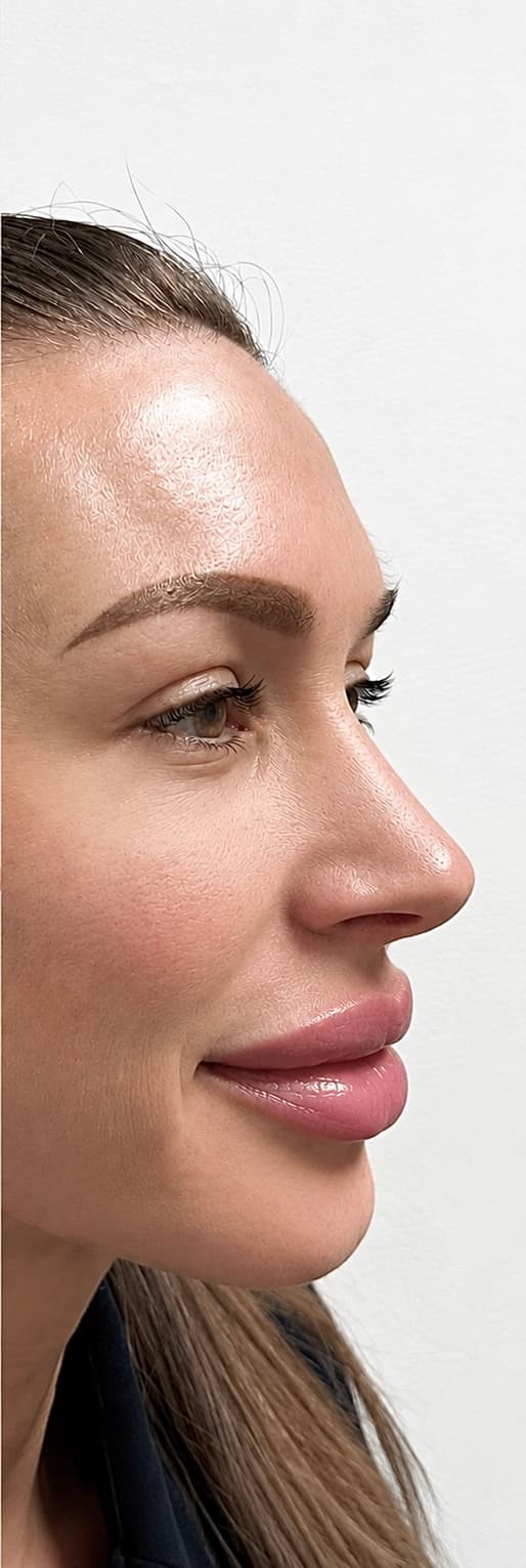 Botulinum Toxin Treatment