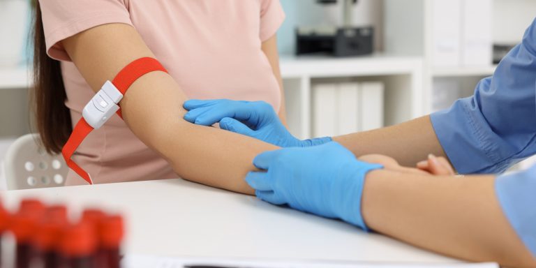What should not be done after having blood drawn from a vein for tests