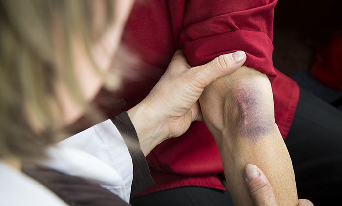 Why does a vein hurt after an IV drip?