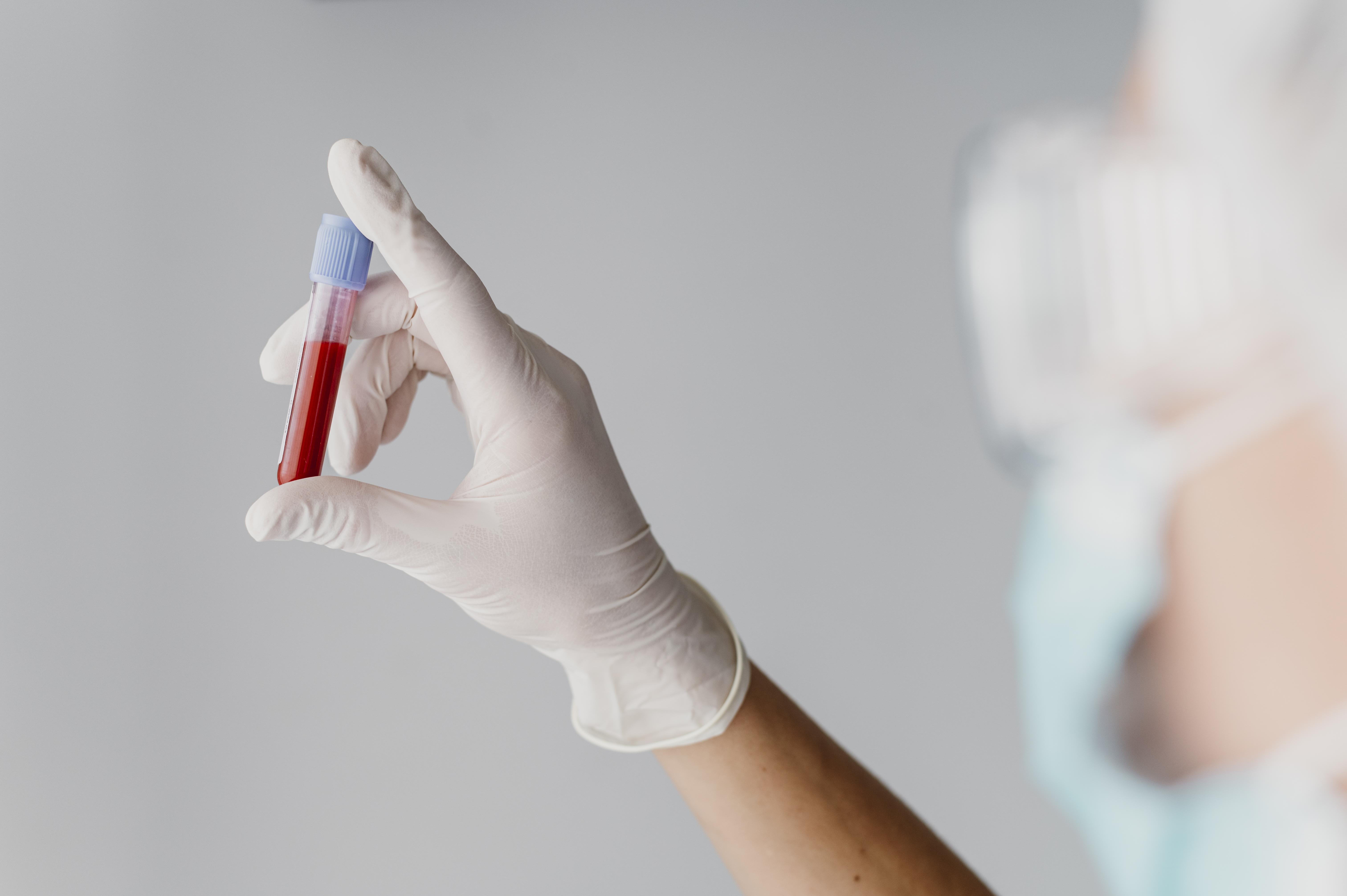 What should not be done after having blood drawn from a vein for tests