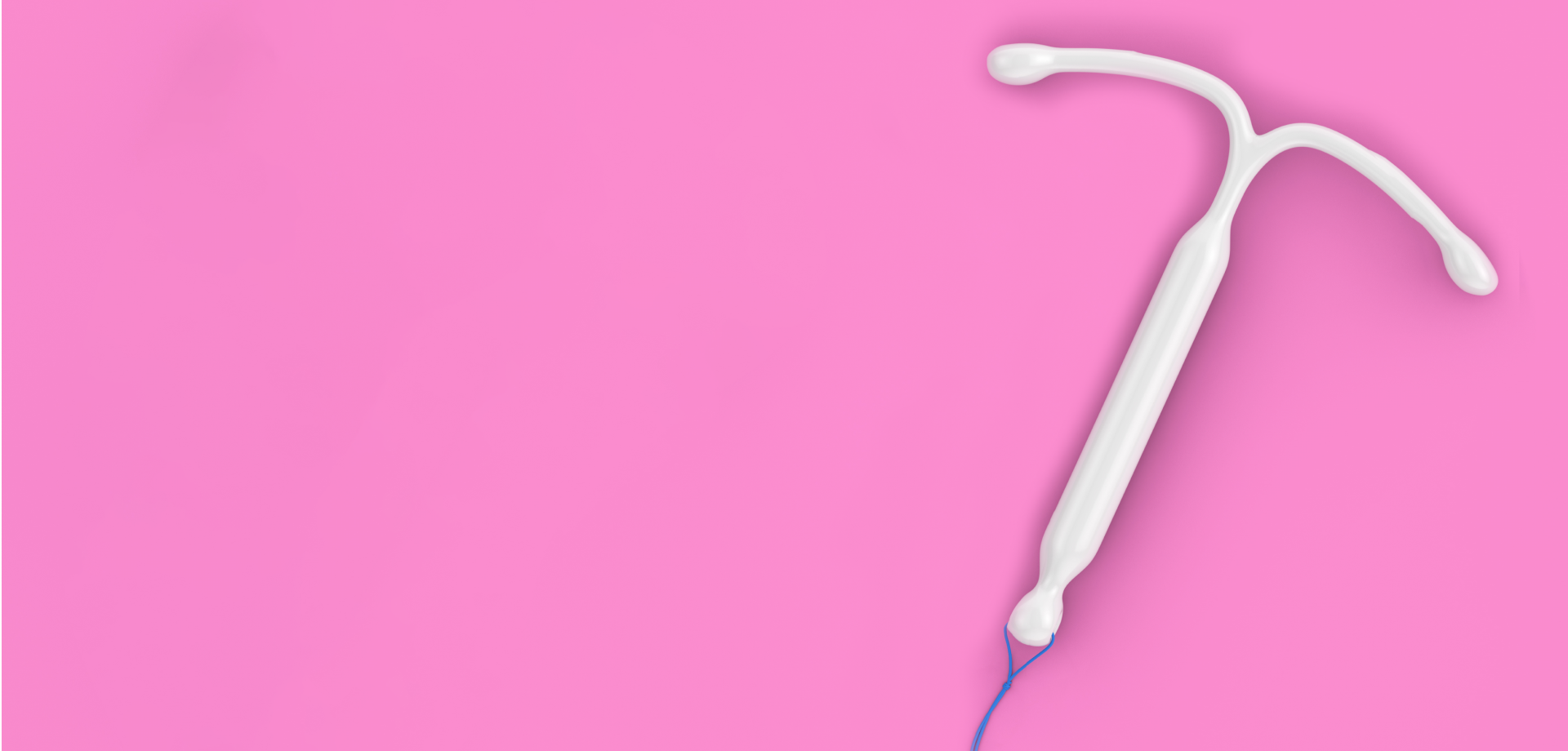 Removal of Intrauterine Device (IUD)