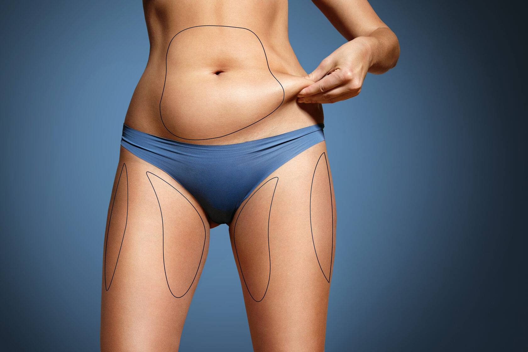 Body fat-dissolving injections as a non-surgical alternative to liposuction in Abu Dhabi
