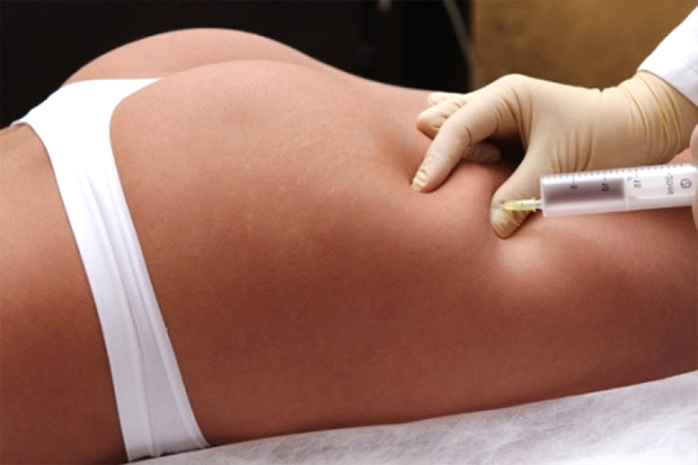 Body fat-dissolving injections as a non-surgical alternative to liposuction in Abu Dhabi