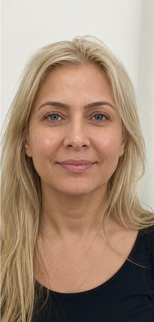 PRP Therapy for Face
