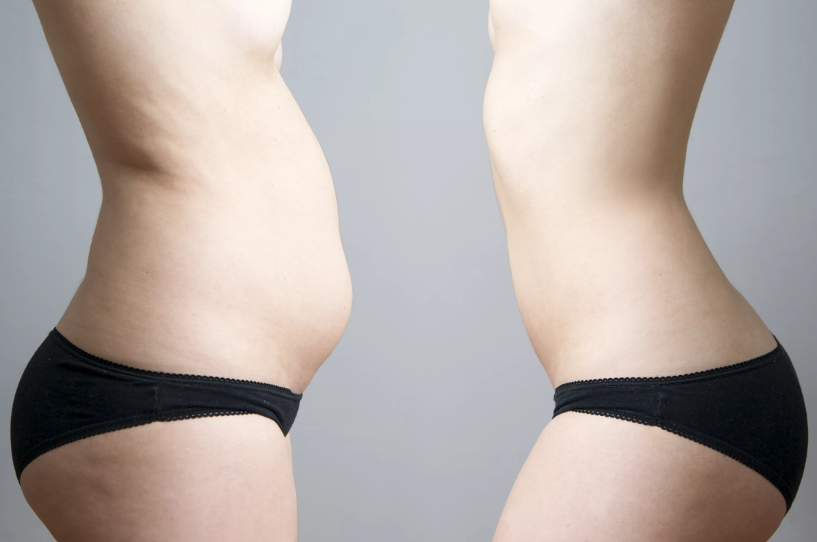 How to get rid of visceral fat