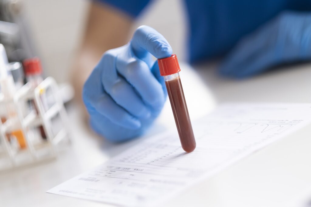 Female hormone tests: when to take them?