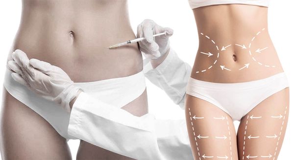 Body fat-dissolving injections as a non-surgical alternative to liposuction in Abu Dhabi